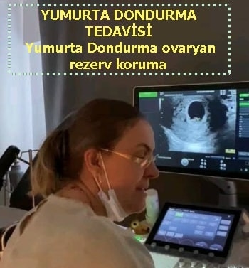 Yumurta Dondurma ovaryan rezerv koruma